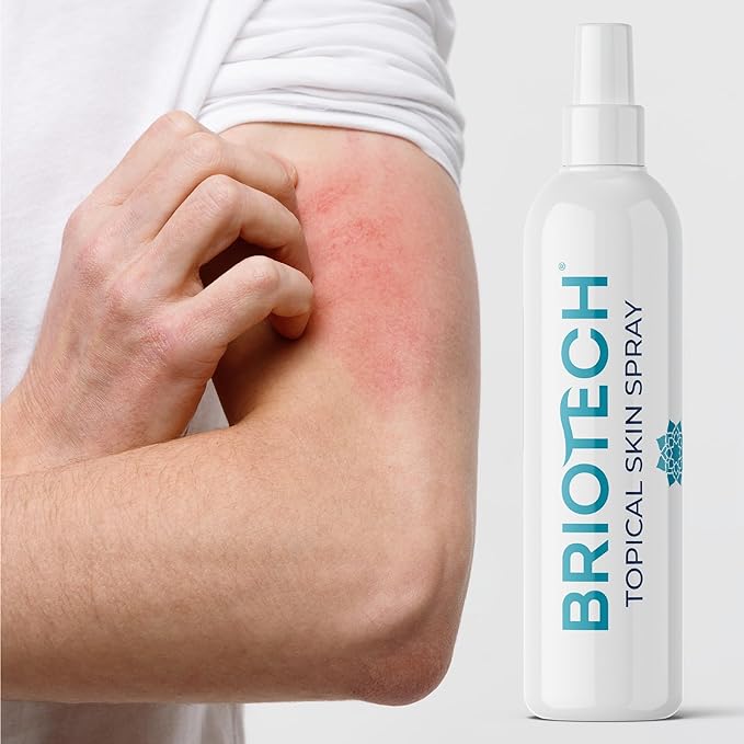 (B00YZDHMWW) - BRIOTECH Topical Skin Spray, Hypochlorous Acid Spray for Body & Face