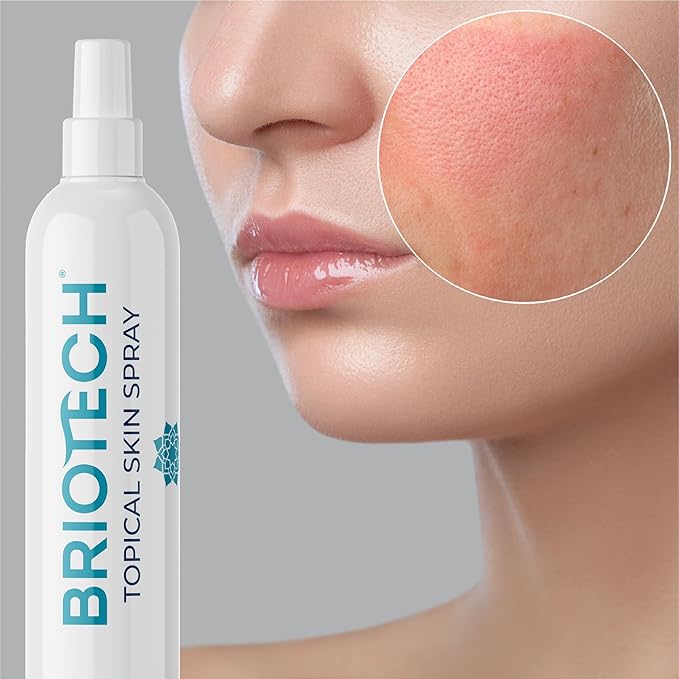 (B00YZDHMWW) - BRIOTECH Topical Skin Spray, Hypochlorous Acid Spray for Body & Face