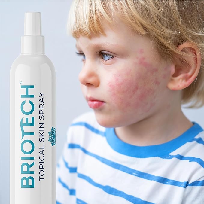 (B00YZDHMWW) - BRIOTECH Topical Skin Spray, Hypochlorous Acid Spray for Body & Face